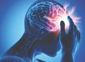 Ai nên tầm soát đột quỵ?