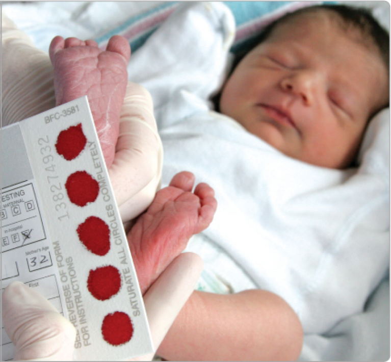 Sàng lọc sơ sinh – Xét nghiệm đầu đời cho bé yêu