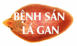 Tư vấn và điều trị bệnh sán lá gan