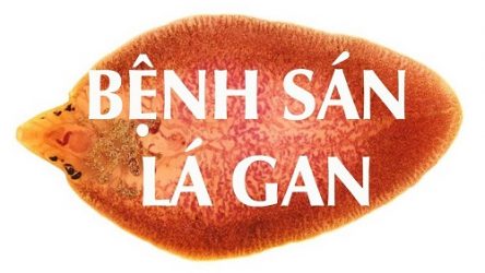 Tư vấn và điều trị bệnh sán lá gan